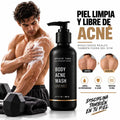 Shield Body Acne*