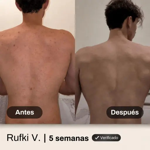Shield Body Acne