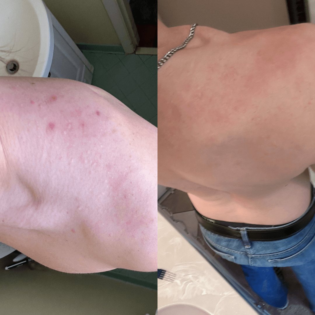 Resultados de antes y después