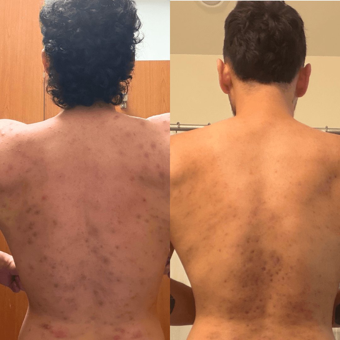 Resultados de antes y después