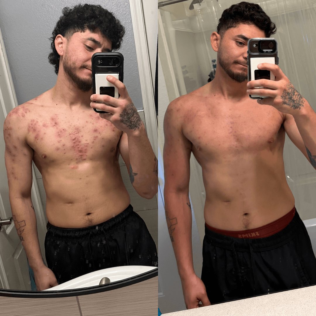 Resultados de antes y después