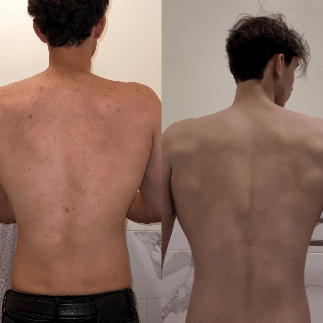 Resultados de antes y después