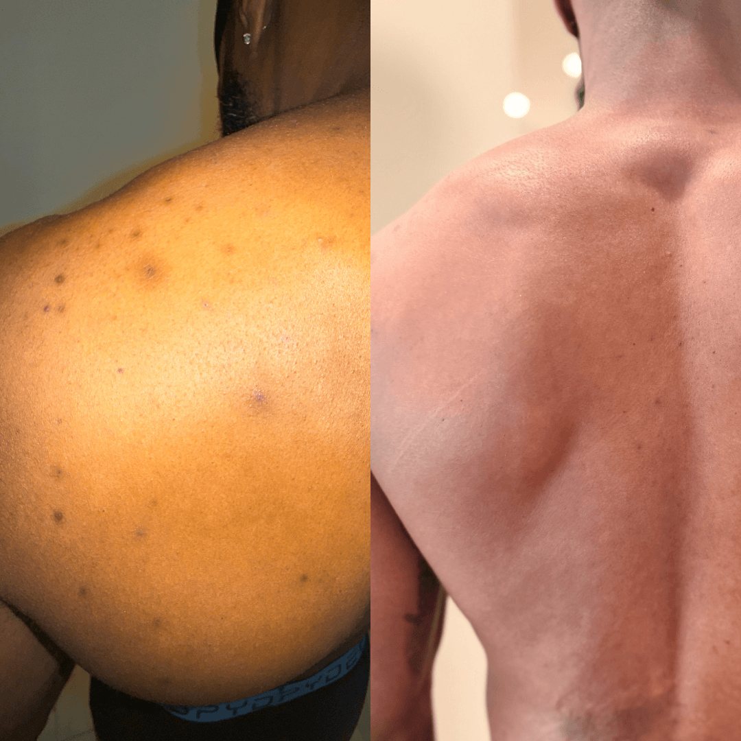 Resultados de antes y después